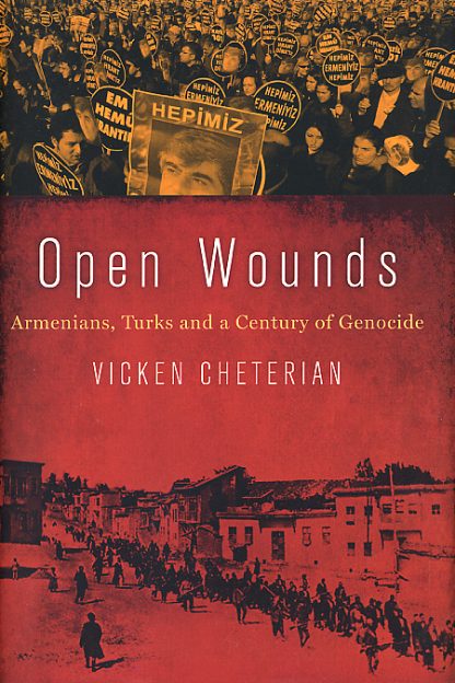 Open Wounds